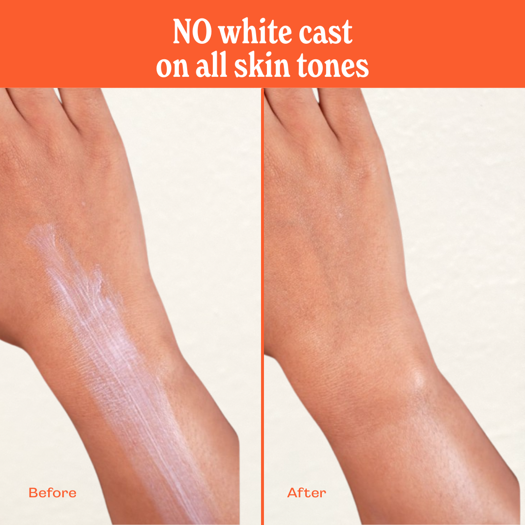 Lotion Commotion